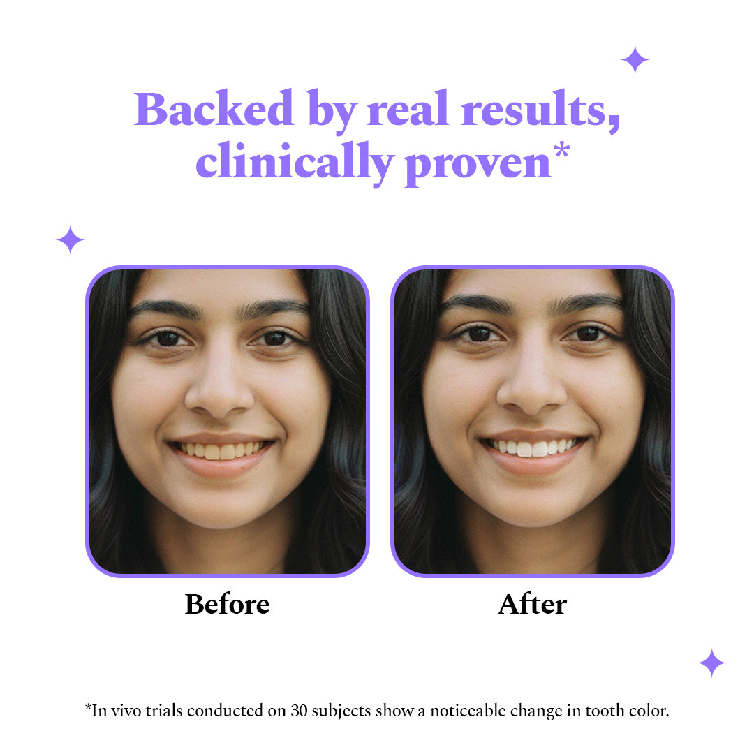 Purple Magic Teeth Whitening Strips - Self Dissolving — reference demo