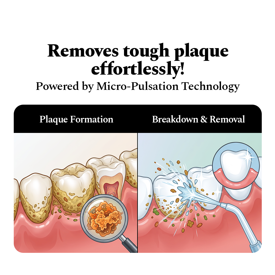 Granite Black Power Flosser + Purple Strips Pack of 3 — reference demo
