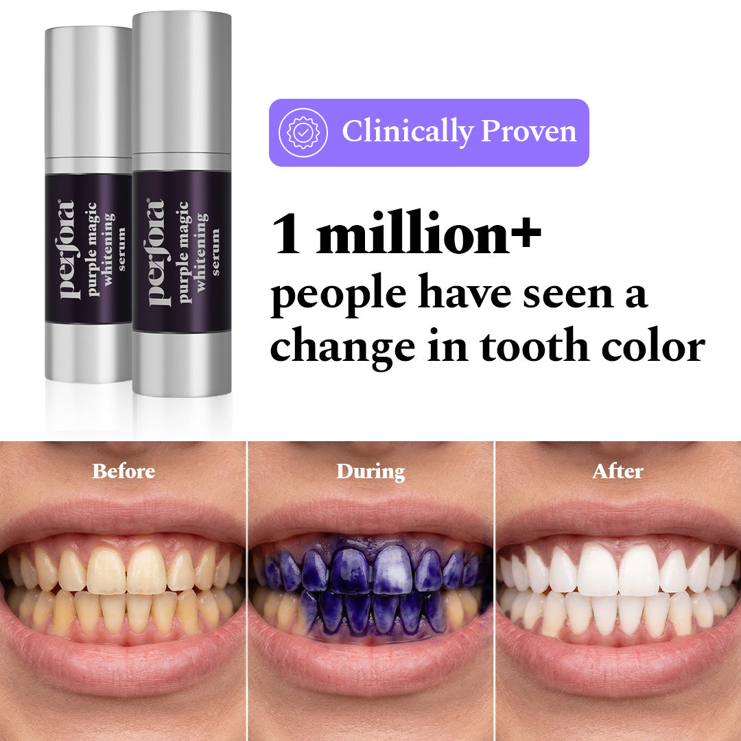 Teeth Whitening Strips & Purple Magic Teeth whitening Serum Combo — reference demo