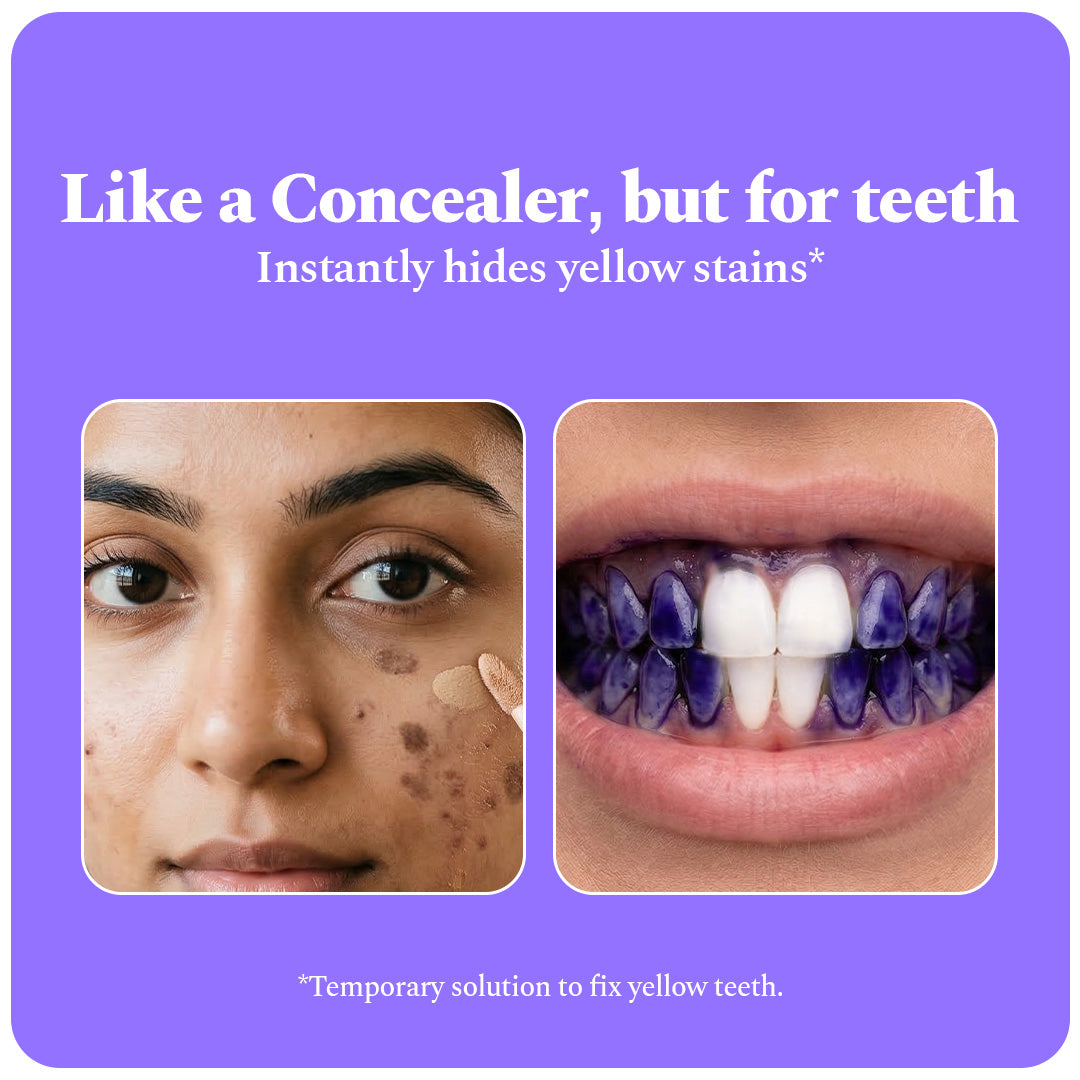 Teeth Whitening Strips & Purple Magic Teeth whitening Serum Combo — reference demo