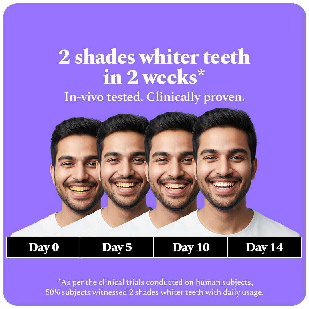 Purple Advanced Teeth Whitening Combo — reference demo