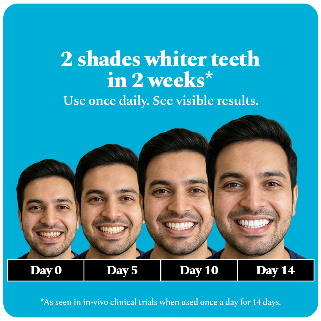Teeth Whitening Strips & Purple Magic Teeth whitening Serum Combo — reference demo
