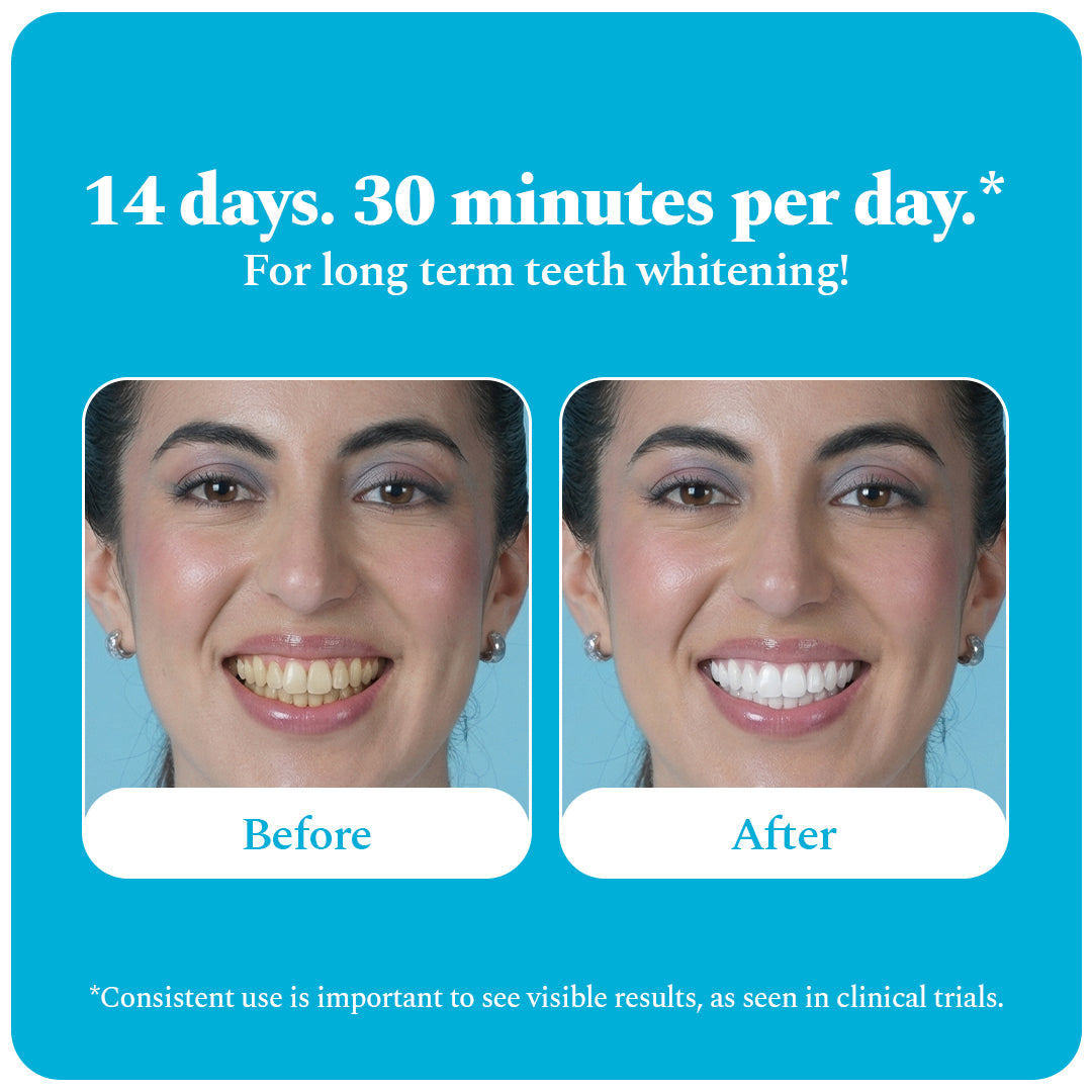Purple Magic Teeth Whitening Serum & Whitening Strips Combo — reference demo