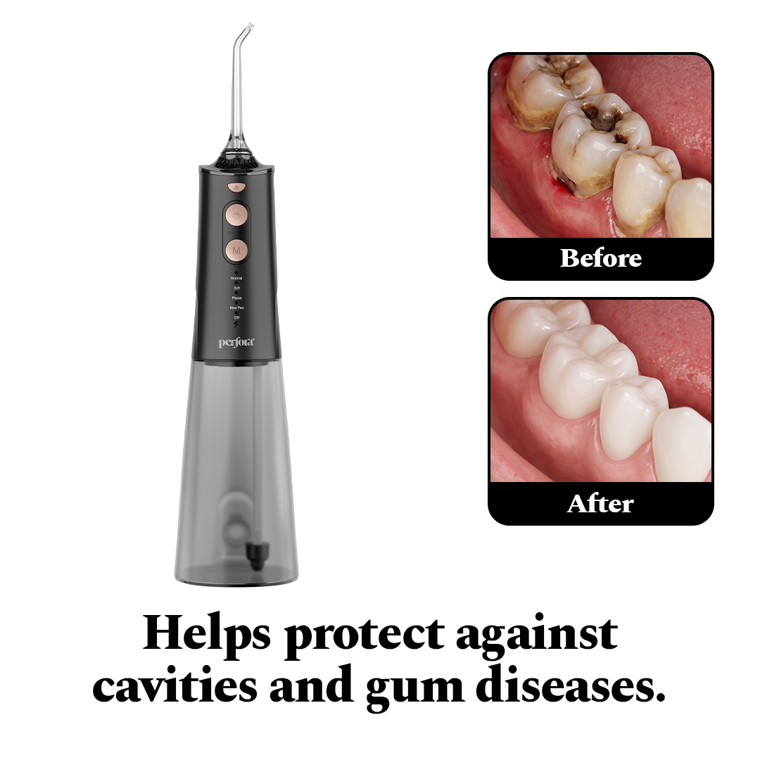 Smart Dental Flosser - Black Gold — reference demo