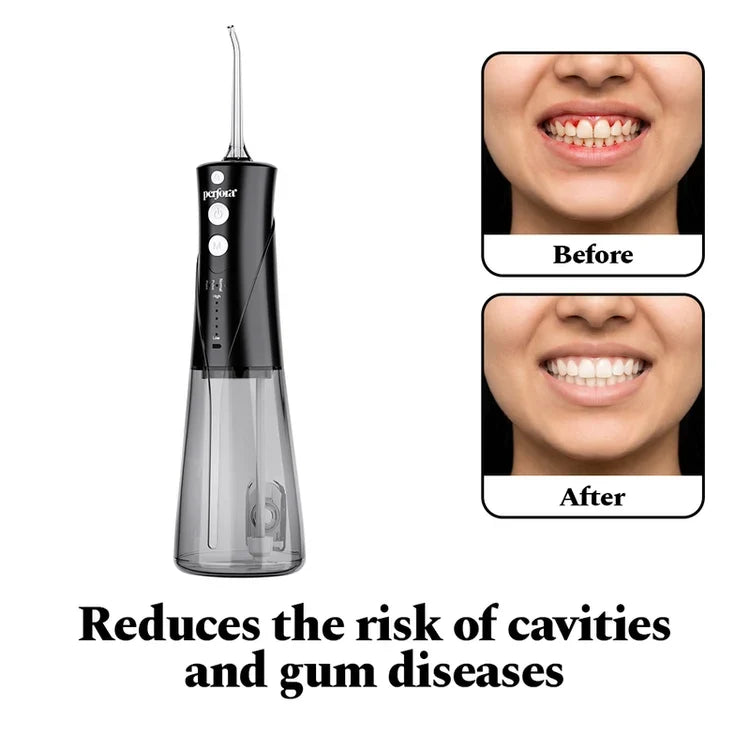 Power Dental Flosser — reference demo
