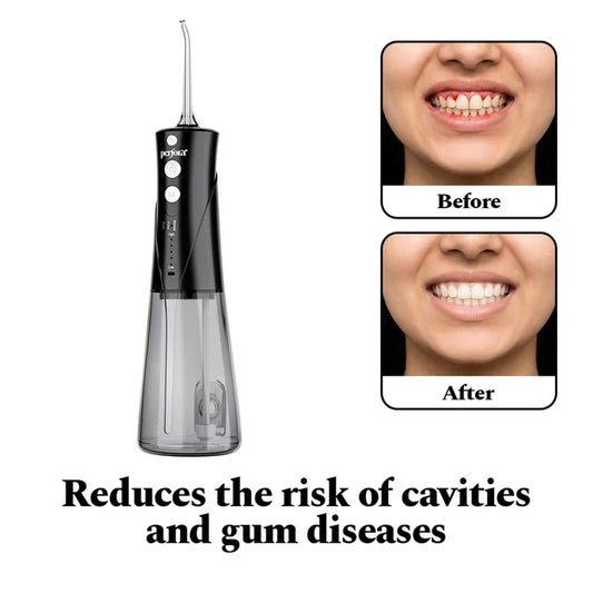 Power Dental Flosser — reference demo