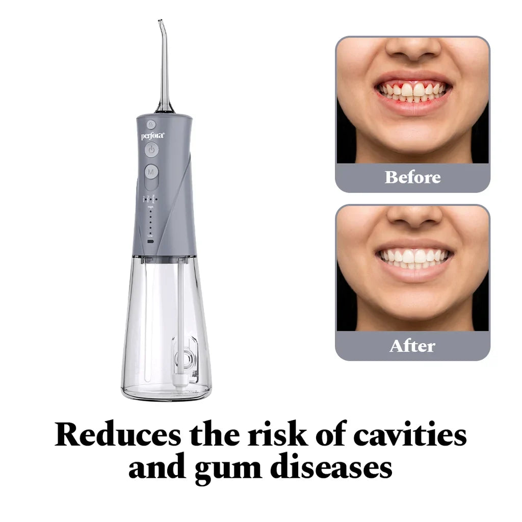 Power Dental Flosser — reference demo